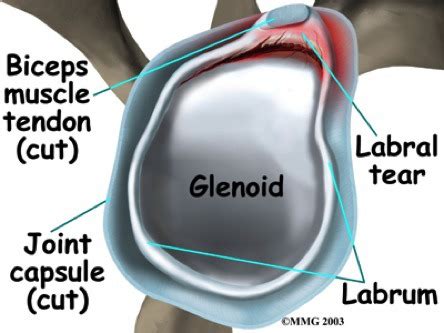 Shoulder Neck Pathologies Flashcards Quizlet