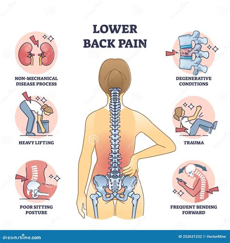 Dolor De Espalda Inferior Y Esqueleto Doloroso De La Espina Dorsal