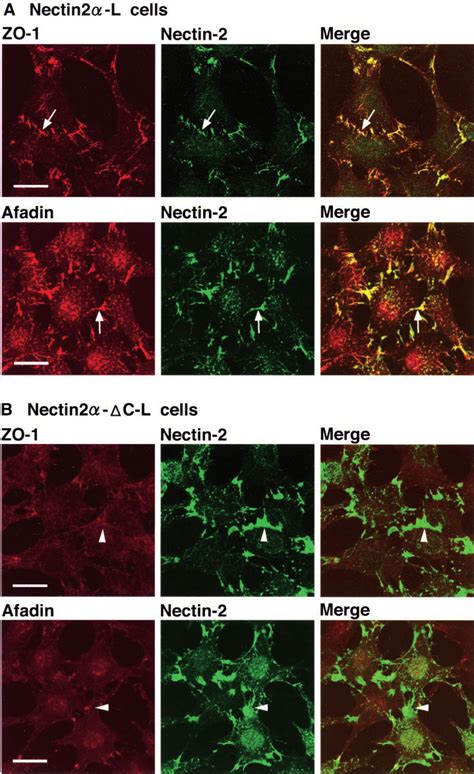 Afadin Dependent Recruitment Of Zo 1 To Nectin 2 Based Cellcell