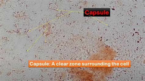 Capsule Staining Introduction Principle Requirements Procedure Result