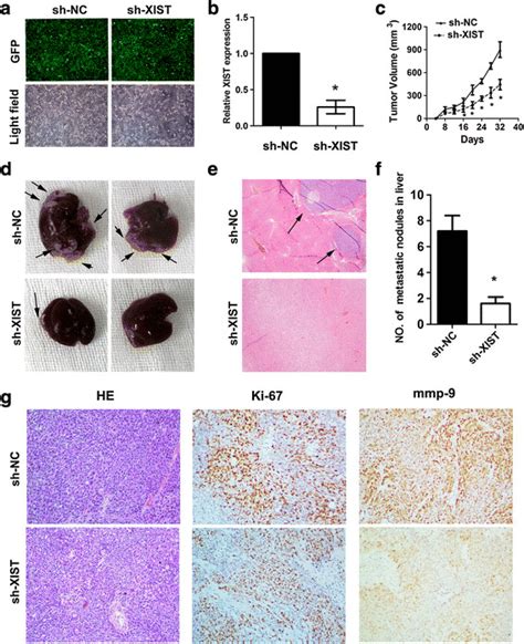 Knockdown Of Lncrna Xist Expression Inhibits Tumor Growth And