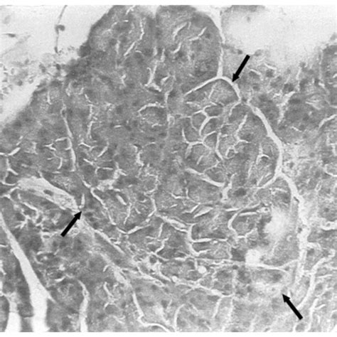 Atypical Acinar Cell Focus In Rat Pancreas ×400 Download