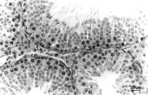 Involvement Of Glucocorticoids In Testicular Involution After Active