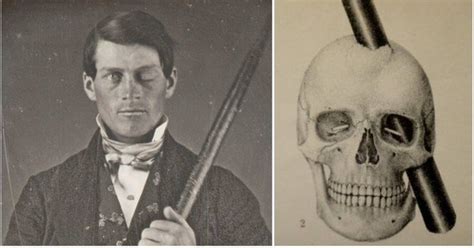 Phineas Gage Và Vụ Tai Nạn đã Khai Sinh Ra Khoa Học Thần Kinh Hiện đại