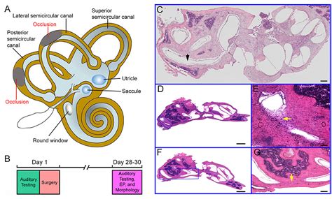 Frontiers Occlusion Of Two Semicircular Canals Does Not Disrupt