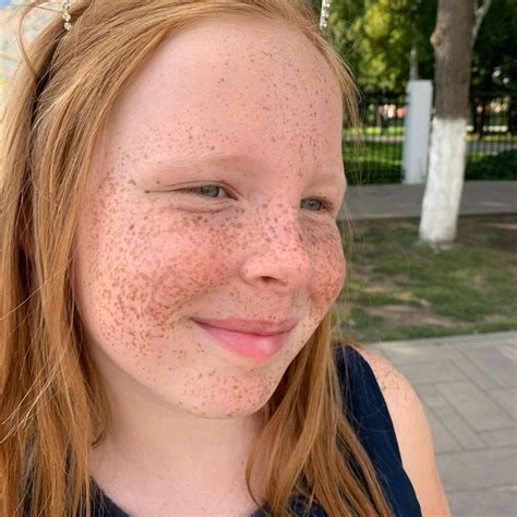 Taches De Rousseur Red Haired Beauty Red Hair Freckles