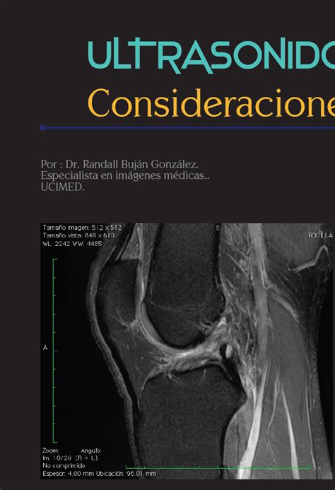 Ultrasonido De Rodilla Consideraciones Diagn Sticas Ucimed