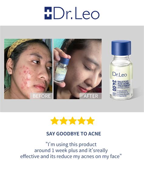 [buy 1 Take 1] Dr Leo Acne Net Acne Essence Salicylic Acid Anti Acne