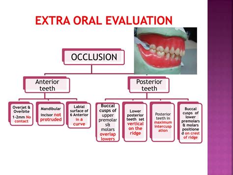 Ppt Try In Of Complete Dentures Powerpoint Presentation Free Download Id4997759