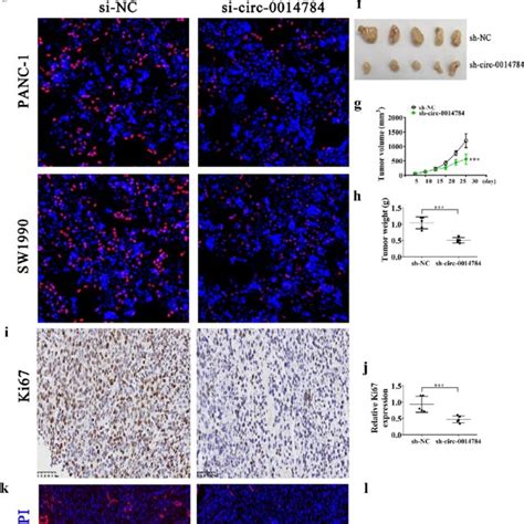 Hsa Circ Downregulation Inhibited Pc Cell Migration And