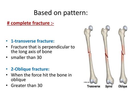 Classification of fracture | PPT