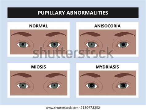 54 Miosis Stock Vectors and Vector Art | Shutterstock