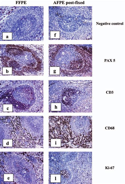 Normal Spleen Of Sprague Dawley Rat 30 Weeks Old Ihc Comparison Download Scientific Diagram