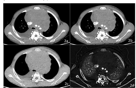 Figure From Value Of Ct Spectral Imaging In The Differential