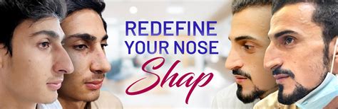 Rhinoplasty Dr Habib Cosmetic Hair Transplant Clinic