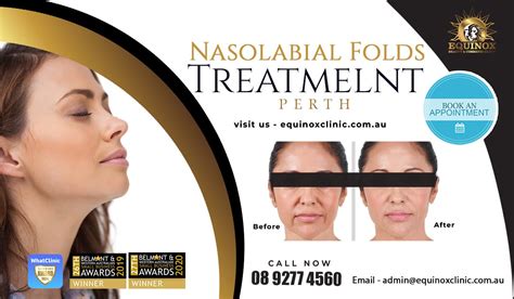 Unveiling The Benefits And Aspects Of Nasolabial Folds Treatment By