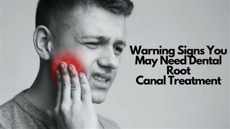 Warning Signs You May Need Dental Root Canal Treatment Gurnee IL