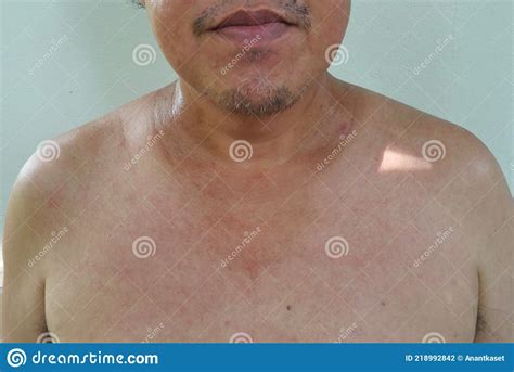 El Cuerpo En Topless Y Los Pechos De Un Hombre Asiático De Mediana Edad