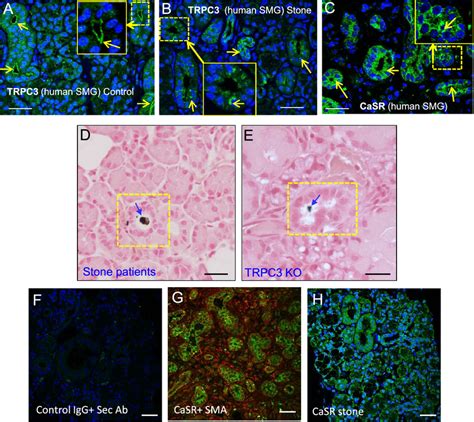 Stone Forming Phenotype In Trpc Ablated Mice Compared To Stone