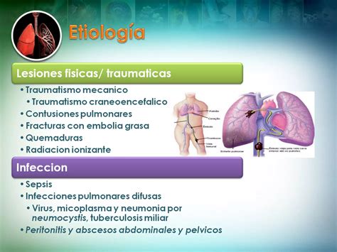 Sindrome De Dificultad Respiratoria Aguda Ppt