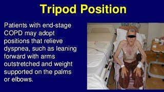 Tripod Position Copd