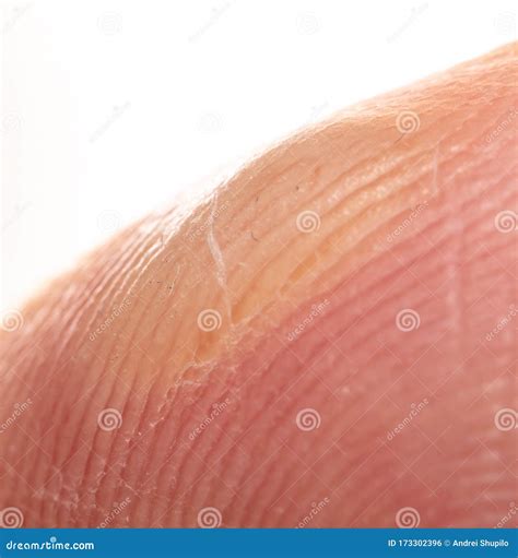 Corn On A Finger Isolated On A White B Stock Photo Image Of Closeup