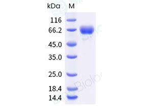 Recombinant Human PD L2 B7 DC Protein 10292 H02H Sino Biological