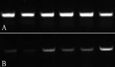 Expression Levels Of The MdGA20 Ox Gene In Hanfu Apple Transgenic