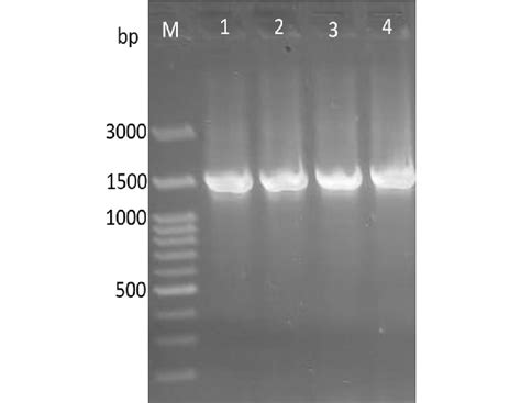 Photograph Of 16s Rdna Gene Amplified Band For The Both Bacterial