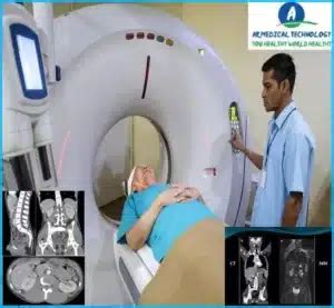 MRI Vs CT Scan Abdomen Best Way To Learn 23- AR MEDICAL TECHNOLOGY