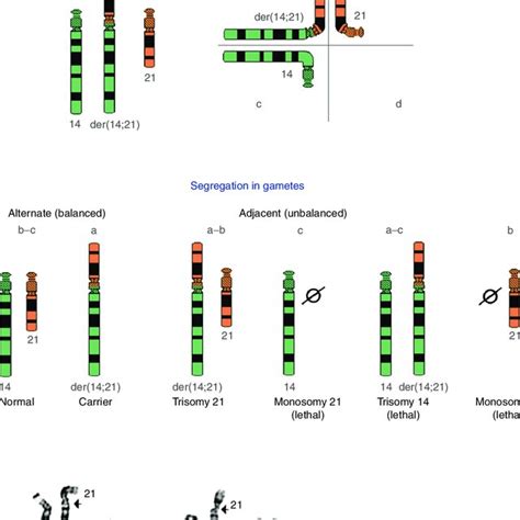 Pdf Robertsonian Translocations