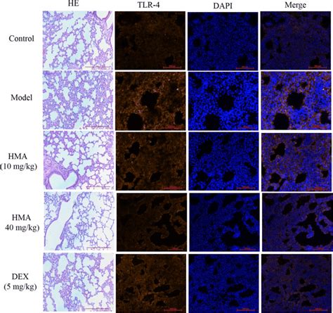 The Effects Of HMA On Histopathological Changes And The Expression TLR4