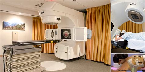 Prone Breast Radiation Therapy At IGRT Health Blog Community Care