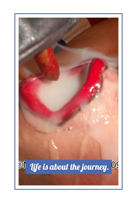 My Journey Pt Nude Pics Xhamster