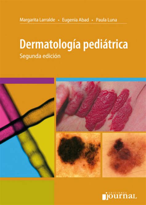 Larralde. Dermatología pediátrica en LALEO