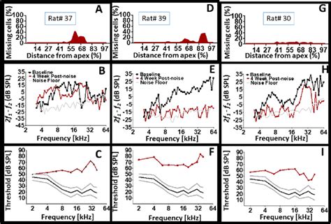 Cochlear structural and functional heterogeneity after exposure to the ...