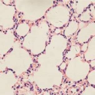 Lung Histological Examination From H E Staining Histological