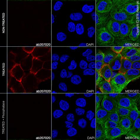 Alexa Fluor® 594 Anti Egfr Phospho Y1173 Antibody E124 Ab207020