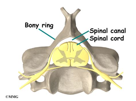 Cervical Radiculopathy - eOrthopod.com