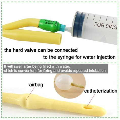 Foley Catheter Sizes: How To Choose The Right Catheter, 52% OFF