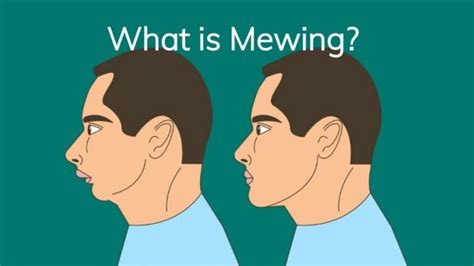 Mewing LÀ GÌ HiỆu QuẢ ĐẠt ĐƯỢc NhƯ ThẾ NÀo