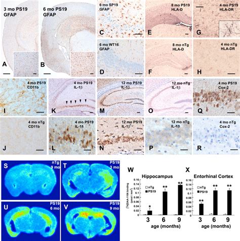 Synapse Loss And Microglial Activation Precede Tangles In A P301s