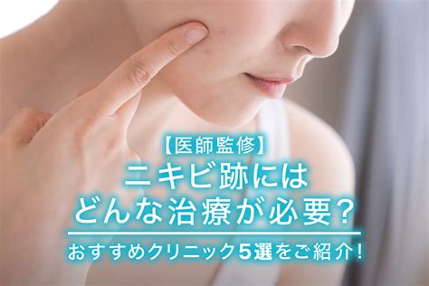 【医師監修】ニキビ跡にはどんな治療が必要？おすすめクリニック5選をご紹介！