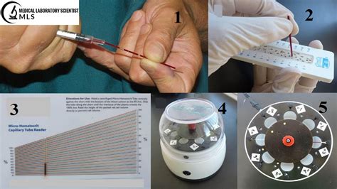 Microhematocrit Reader