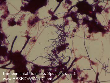 filamentous-nocardia-gram-stain | EBS