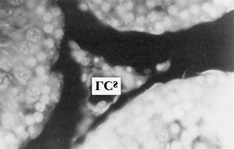 Acridine Orange And Propidium Iodide Staining Leydig Cell Degeneration