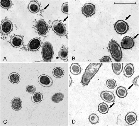 Mutations In The Waar Gene Of Escherichia Coli Which Disrupt