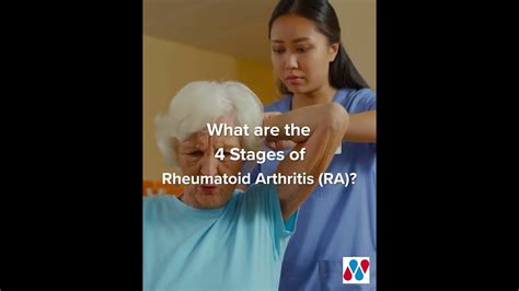 What Are The Stages Of Rheumatoid Arthritis Youtube