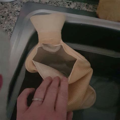 Woman 41 Watched Skin Rip Away After Hot Water Bottle Exploded And Left Her With Second