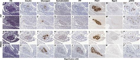 Notch Rbp J Signaling Prevents Premature Endocrine And Ductal Cell